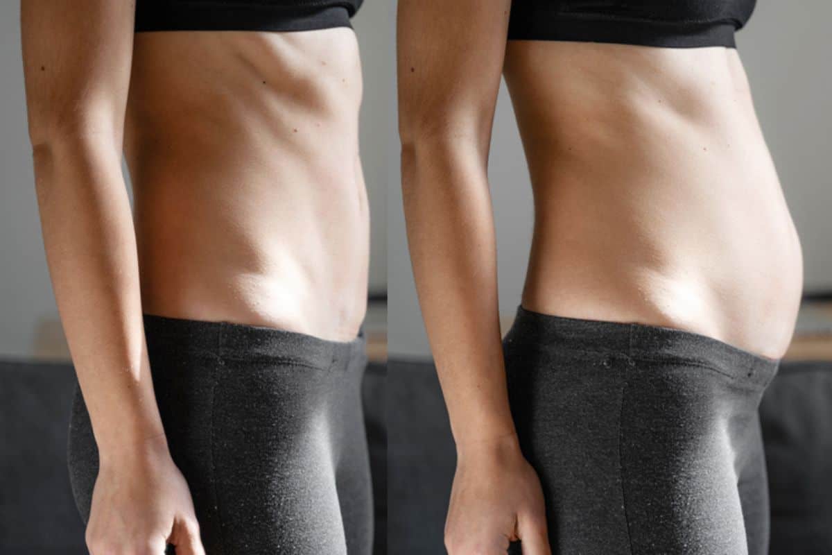 How long does diastasis recti take to improve South Yardley?