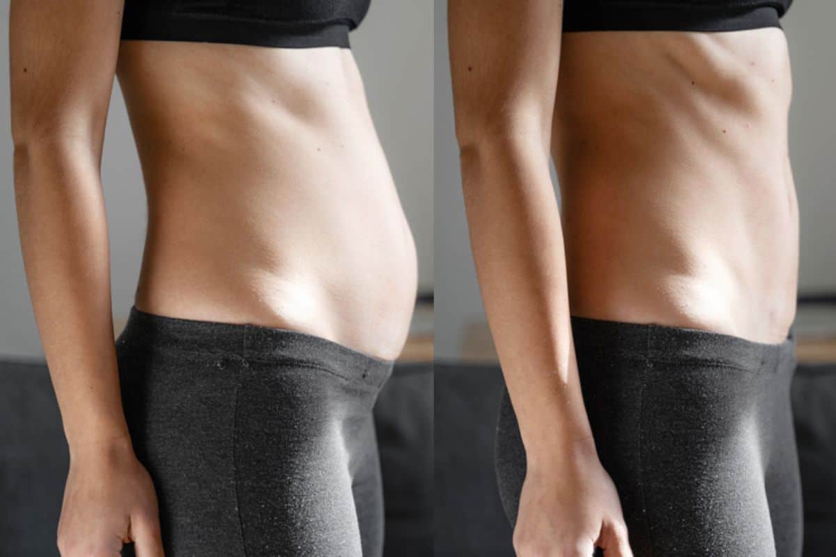 Post-Pregnancy: What Happens to Your Abdominal Muscles After Birth South Yardley