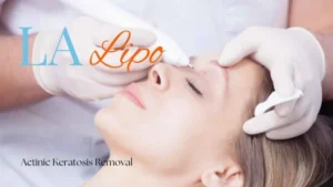Woman receiving Actinic Keratosis Removal Treatment South Yardley