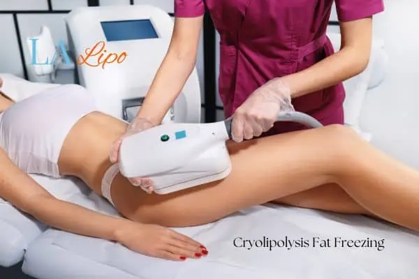 Woman receiving coolsculpting South Yardley treatment on her thighs