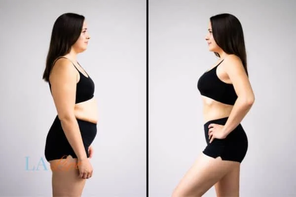 link between body image and mental health South Yardley