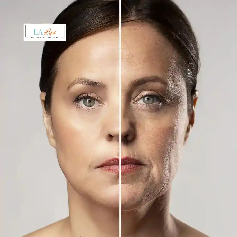 How Can You Tell If Non-Surgical Skin Tightening Is Right for You South Yardley?