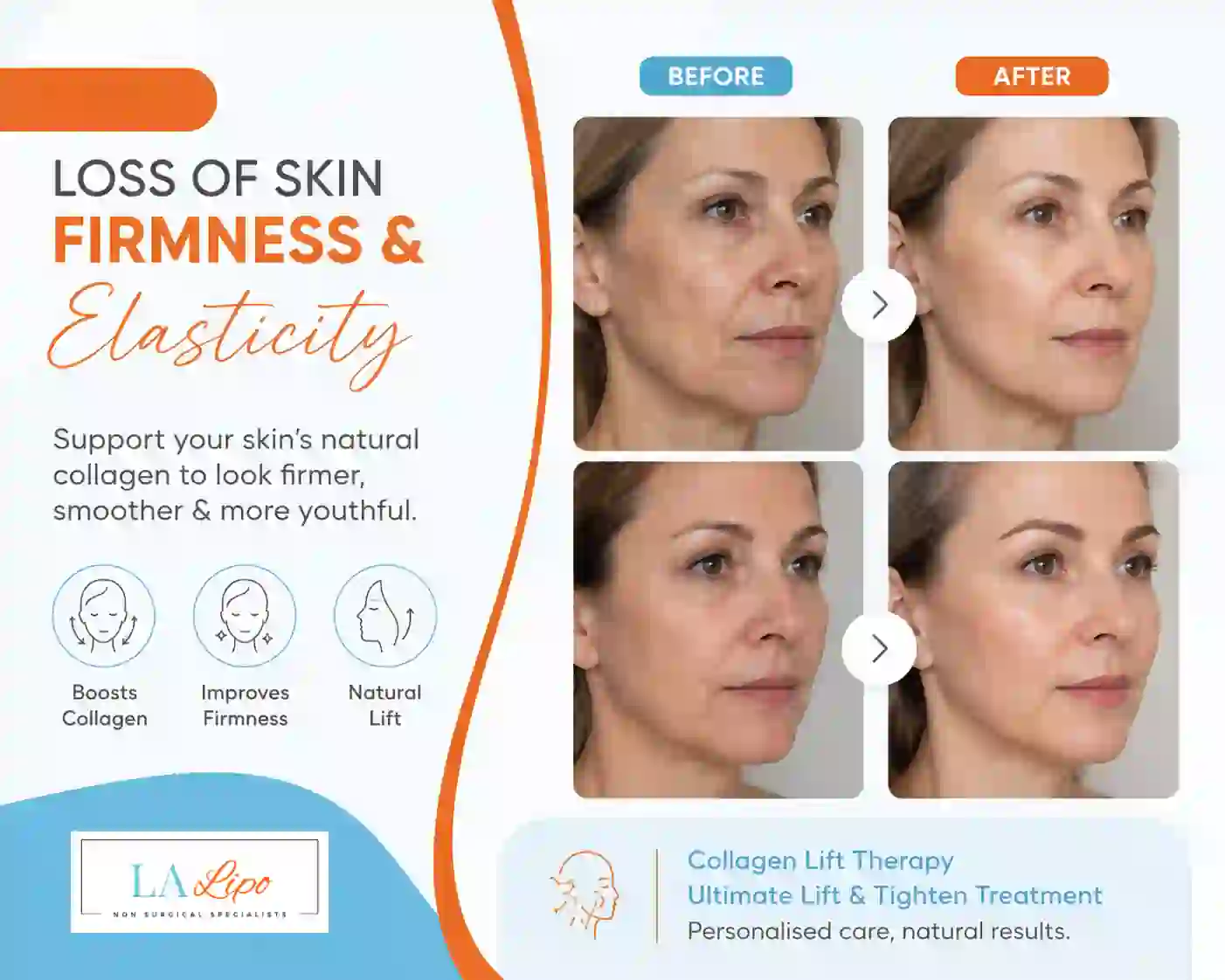 Sign #7: Loss of Skin Firmness and Elasticity South Yardley