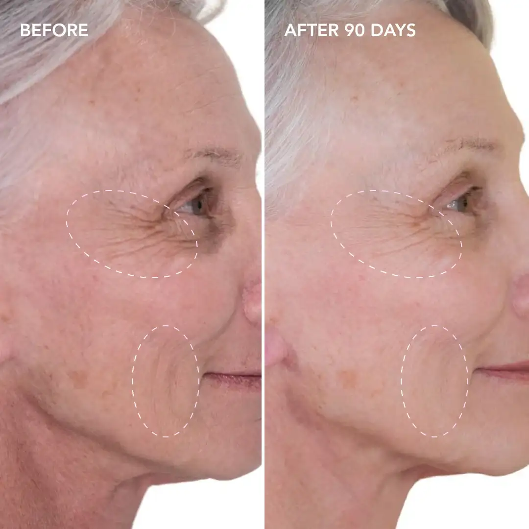 When will you see results South Yardley